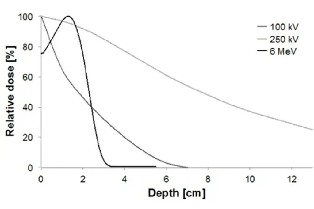 A graph showing relative dose (%) versus depth (cm) for 100 kV, 250 kV, and 6 MeV beams—often used in treating Dupuytren’s contracture symptoms—reveals dose decreases with depth; 6 MeV falls sharply after 2 cm, while others decrease more gradually.