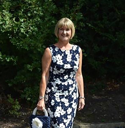 A woman stands outdoors on a sunny day, wearing a sleeveless navy blue and white floral dress and holding a matching handbag. Although she has Dupuytren’s contracture symptoms, she enjoys the fresh air among green foliage.