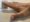 A hand rests flat on a surface with fingers extended—commonly checked in cases of Dupuytrens contracture disease. A ruler is held perpendicular to the pinky, measuring its length. The scene is well-lit and focuses on the hand and ruler.