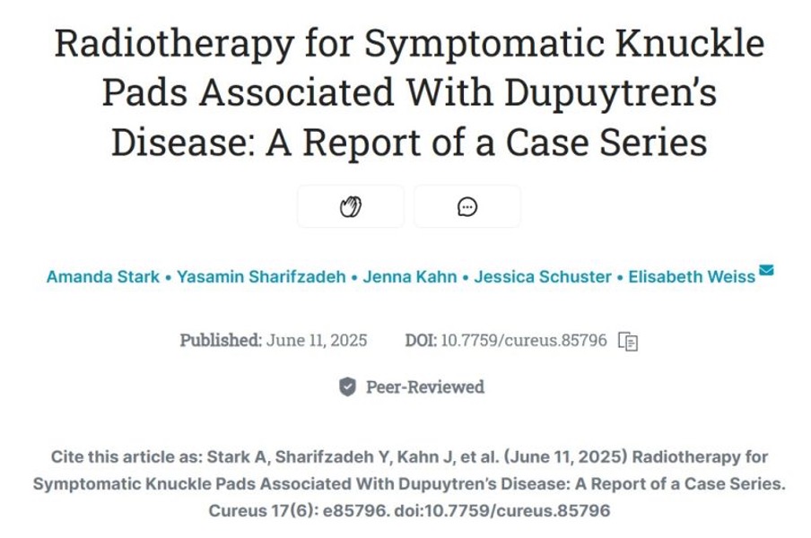 Radiotherapy for Garrod’s pads (knuckle pads)