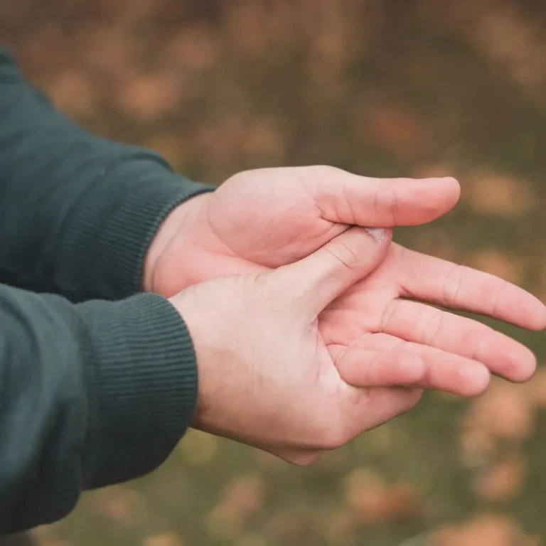 man-scratching-his-hand