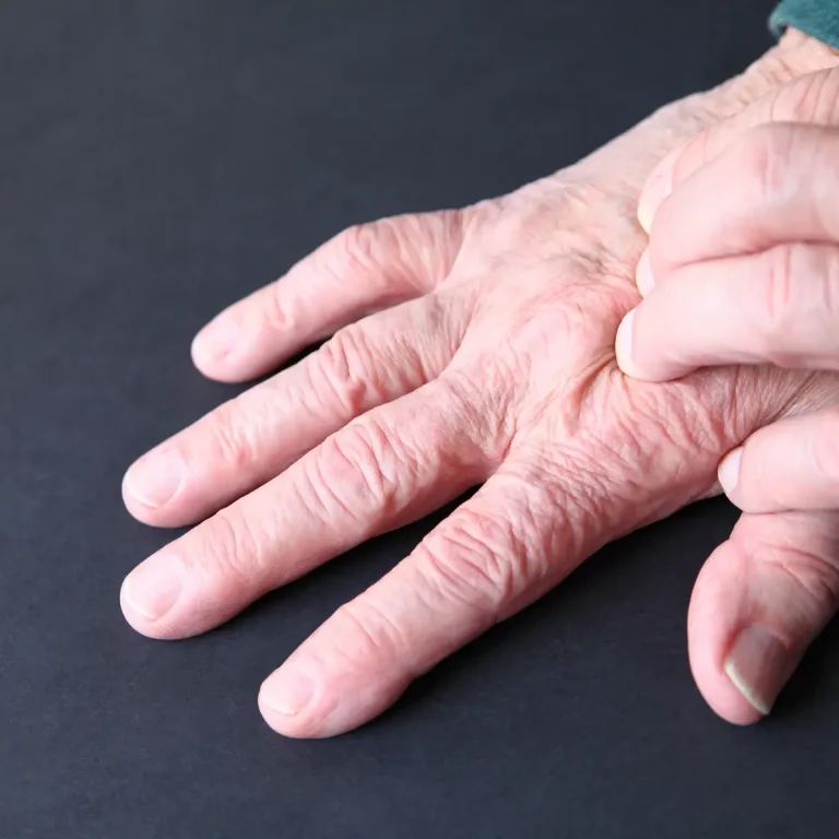 senior-hand-massaging-another-hand-on-background-2026-03-26-07-02-39-utc